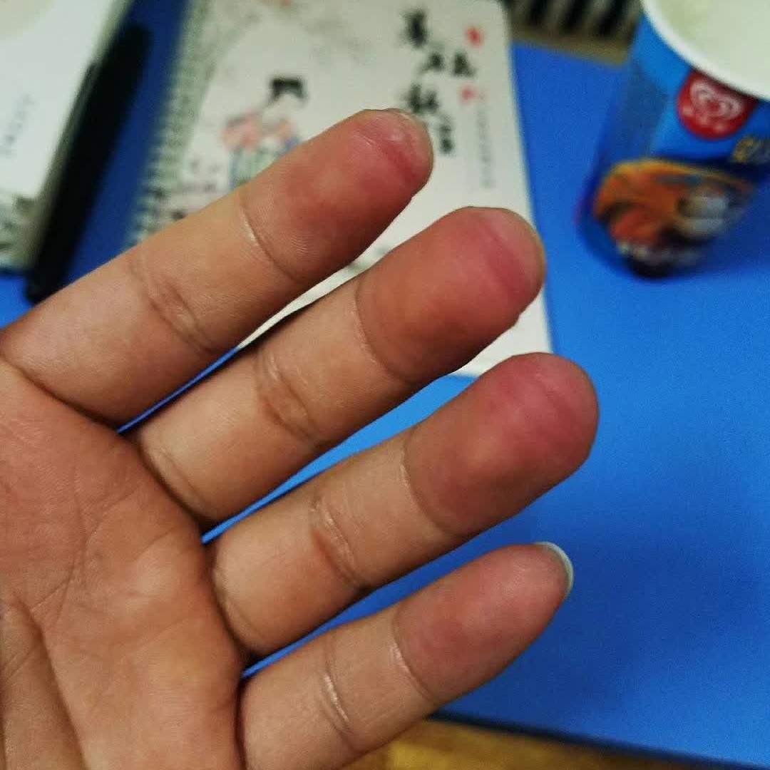 刚开始学尤克里里时的手指头